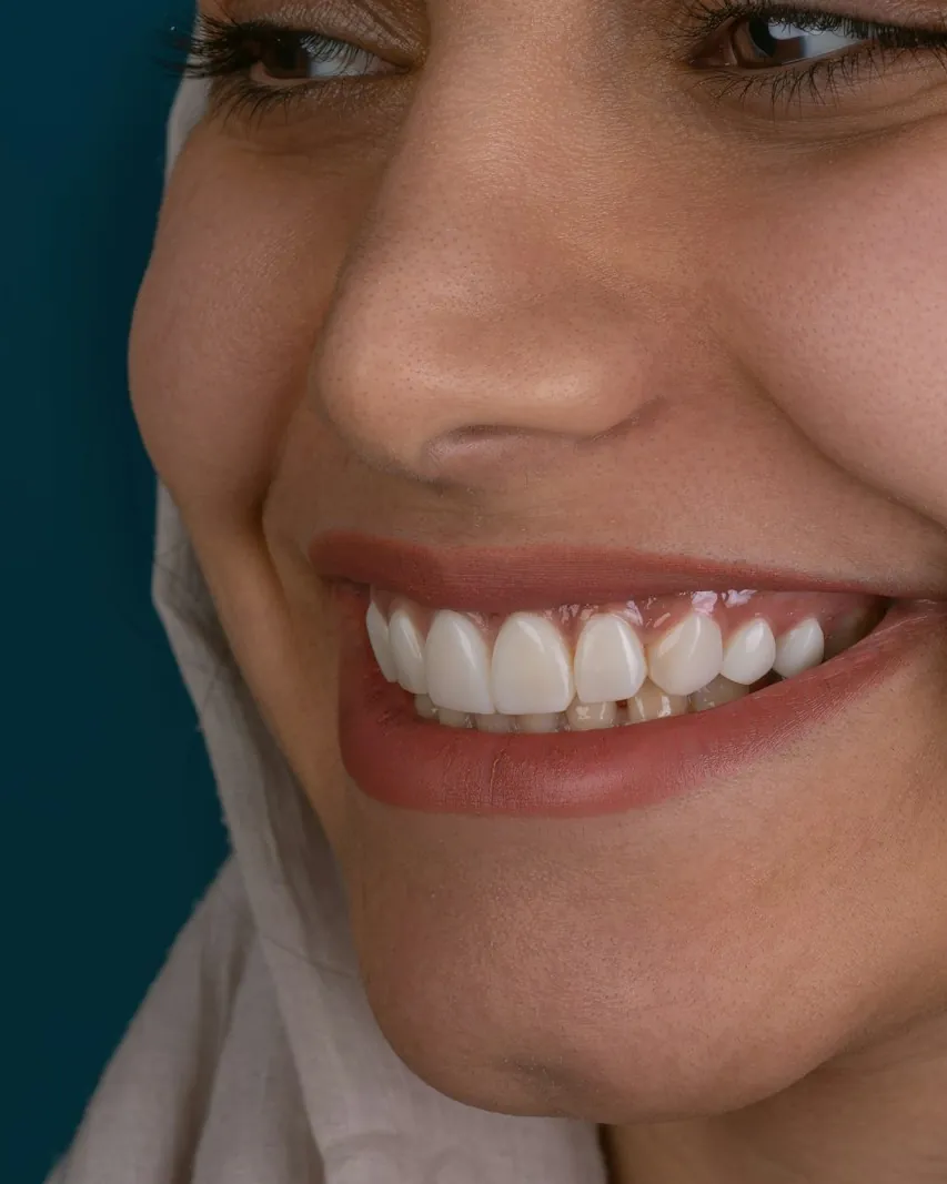ابتسامة طبيعية بعد العلاج